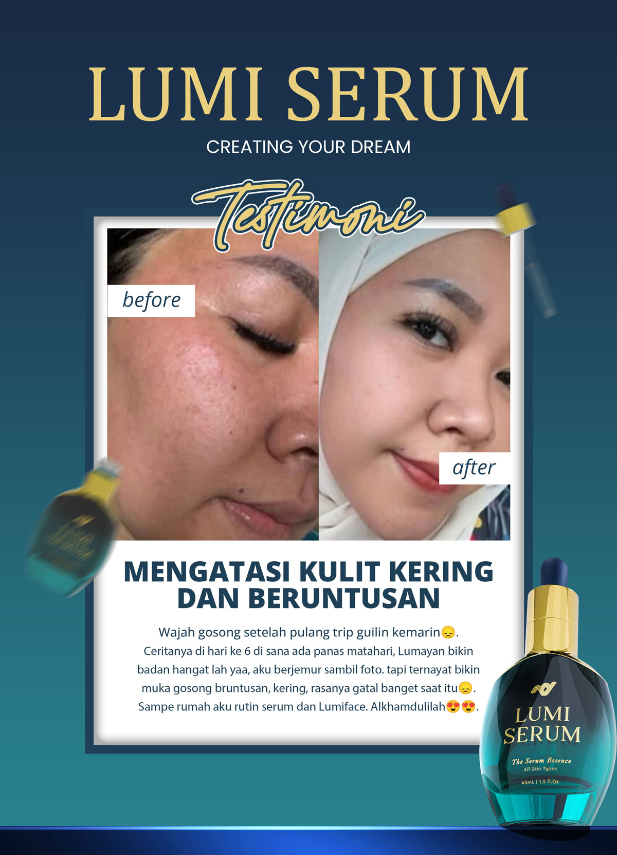 testi